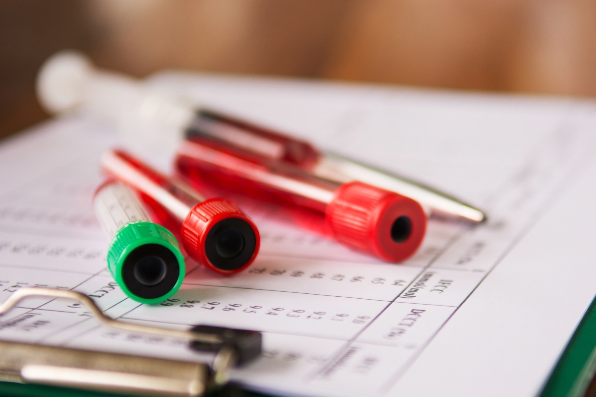 glicemia e hemoglobina glicada